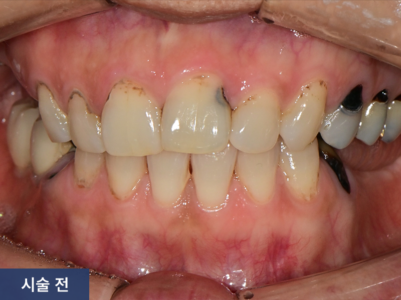 일반진료 사례 1