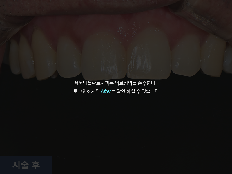 일반진료 사례 2