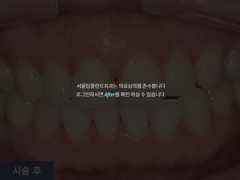 일반진료 사례 3