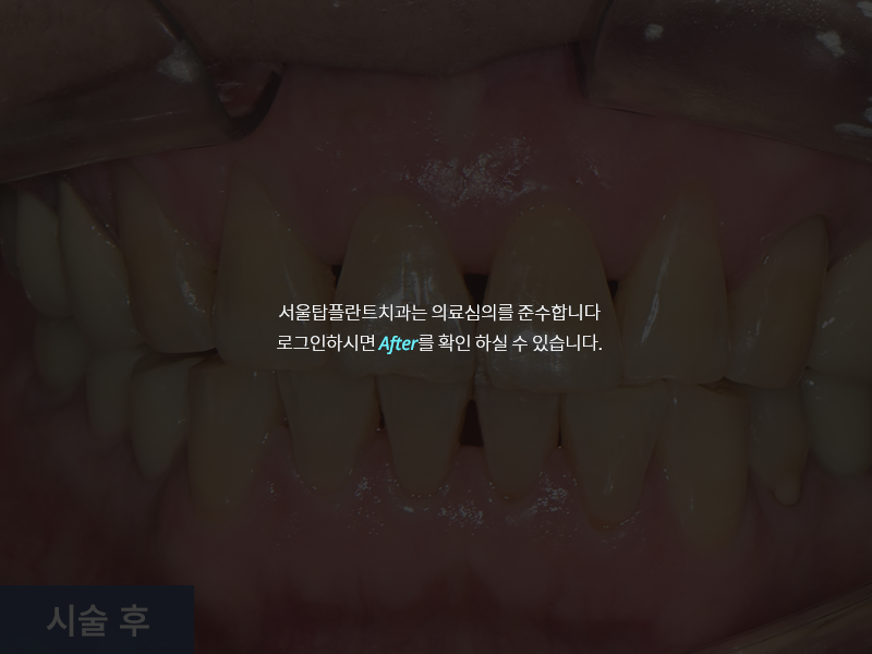 일반진료 사례 4