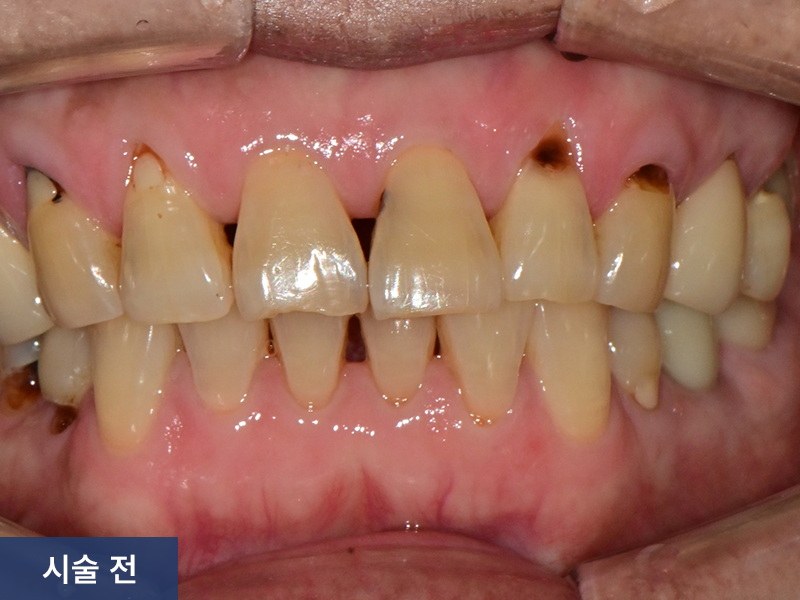 일반진료 사례 4